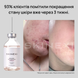 Розпродаж!!! Лосьйон від прищів та акне Skinexi Dry Lotion Formula+ 100 мл