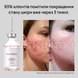 Розпродаж!!! Лосьйон від прищів та акне Skinexi Dry Lotion Formula+ 100 мл
