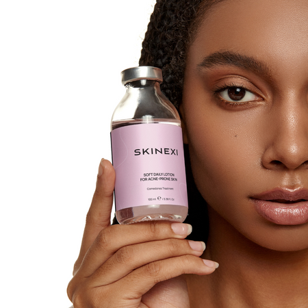 Распродажа!!! Лосьон от комедонов и чёрных точек Skinexi Soft Daily Lotion 100 мл