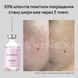 Распродажа!!! Лосьон от комедонов и чёрных точек Skinexi Soft Daily Lotion 100 мл