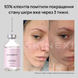 Распродажа!!! Лосьон от комедонов и чёрных точек Skinexi Soft Daily Lotion 100 мл