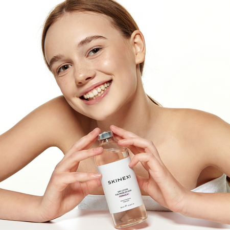 Розпродаж!!! Лосьйон від прищів та акне Skinexi Dry Lotion Formula+ 250 мл