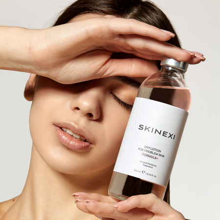 Розпродаж!!! Лосьйон від прищів та акне Skinexi Dry Lotion Formula+ 250 мл