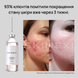 Розпродаж!!! Лосьйон від прищів та акне Skinexi Dry Lotion Formula+ 250 мл