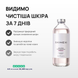 Розпродаж!!! Лосьйон від прищів та акне Skinexi Dry Lotion Formula+ 250 мл