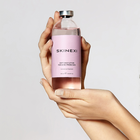 Распродажа!!! Лосьон от комедонов и чёрных точек Skinexi Soft Daily Lotion 250 мл